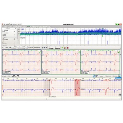 Norav NR-302 Holter 3-kanaals inclusief analyse software, per stuk